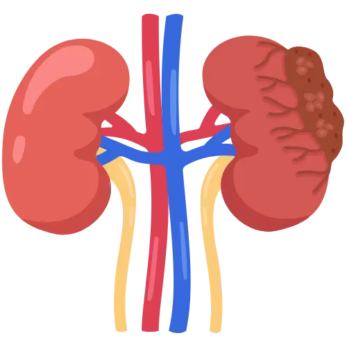 Kidney & Urology Treatments